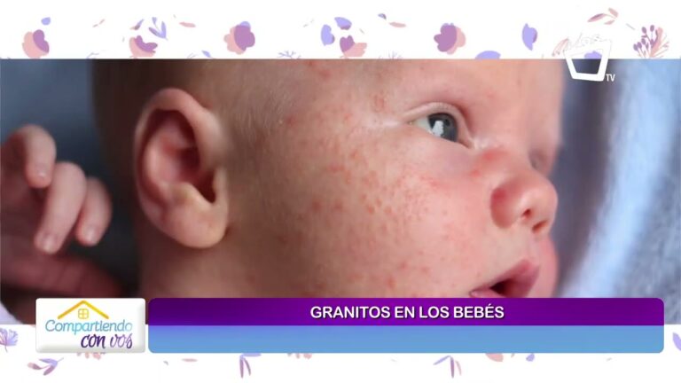 Descubre cómo eliminar los molestos granitos rojos en la cara de tu bebé de 1 mes